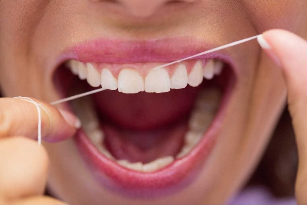 أفضل خيط أسنان: دليل شامل لاختيار النوع المناسب وطريقة الاستخدام الصحيحة